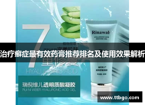治疗癣症最有效药膏推荐排名及使用效果解析